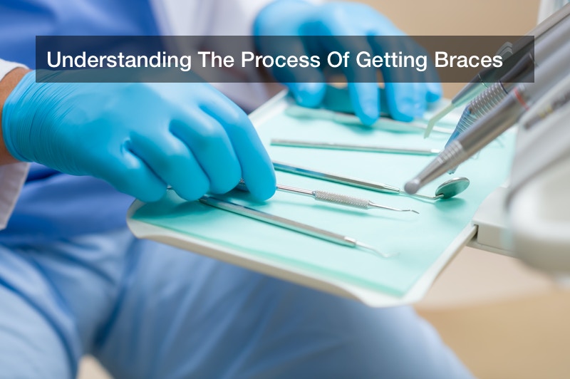 Understanding The Process Of Getting Braces