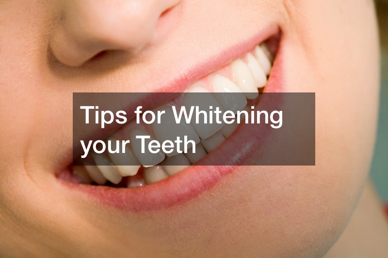 Tips for Whitening your Teeth