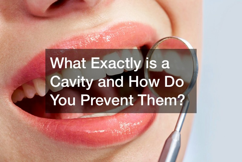 What Exactly is a Cavity and How Do You Prevent Them?