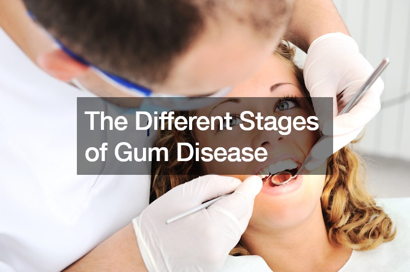 The Different Stages of Gum Disease